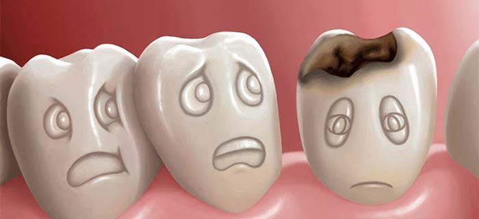 gia-rang-su-trung-tam-nha-khoa-quynh-giang