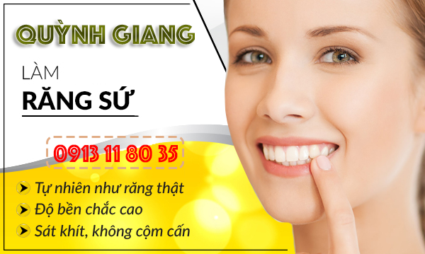 lam-rang-su-tham-gia-bao-nhieu